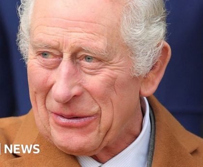 King Charles in hospital for prostate treatment