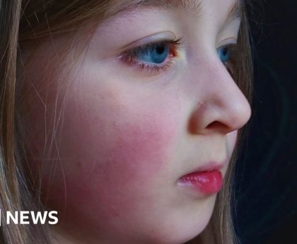 Long Covid: NHS legal action launched by family of girl