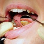 UK exam could be scrapped for foreign dentists