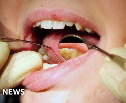 UK exam could be scrapped for foreign dentists