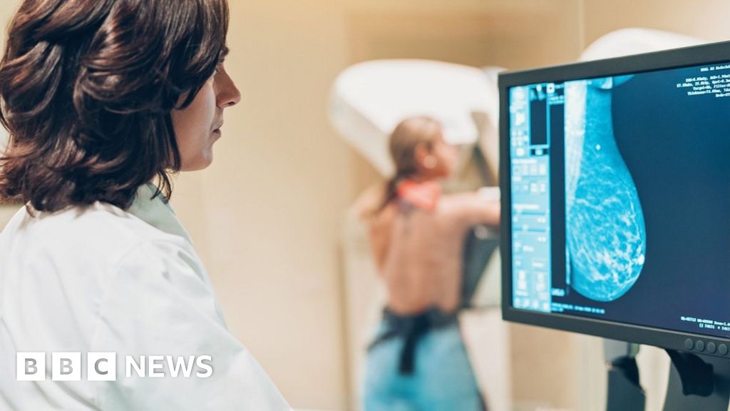 Breast cancer: South Eastern Trust new encompass system causes delays