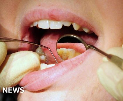 Fees will see more people pull teeth out - dentist