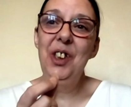 Woman describes unimaginable pain of pulling out own teeth after not getting NHS dentist