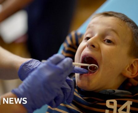 Free dental bus in longest ever visit due to demand