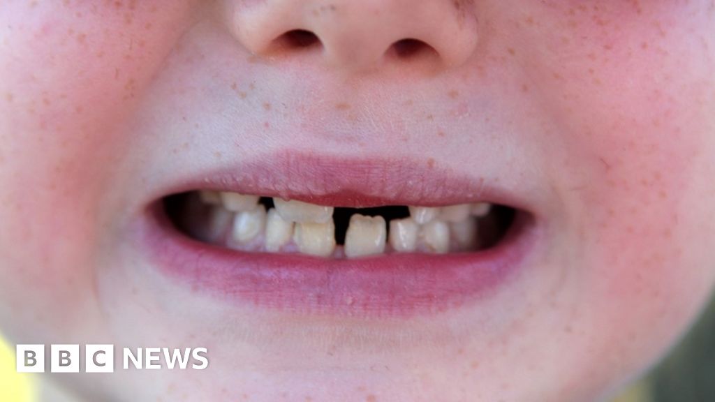 Blackpool mum removed six-year-old child's teeth with pliers - MP