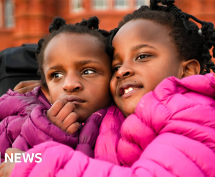 Conjoined twins given days to live are proving everyone wrong